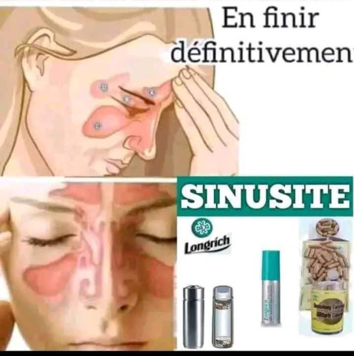contre sunusite - AZALI