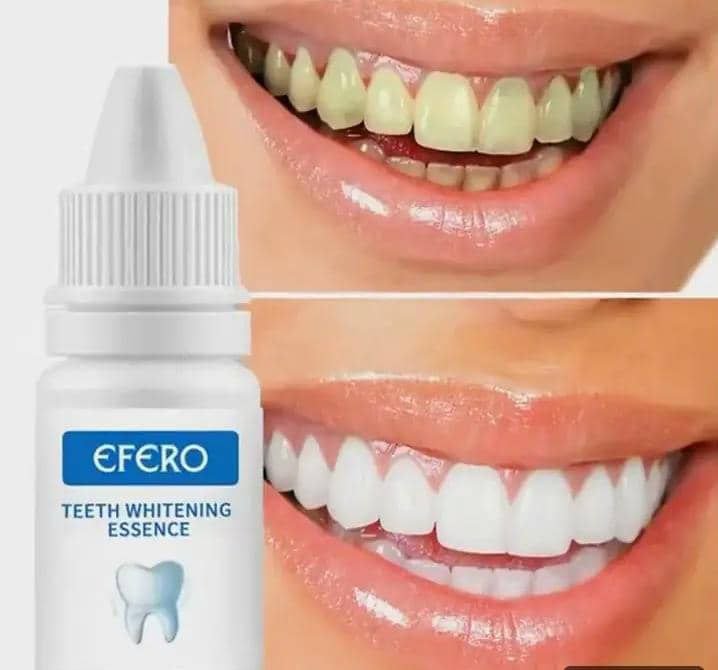 Efero Kit blanchement de dent - AZALI